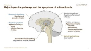 Schizophrenia – Neurobiology and Aetiology – slide 26